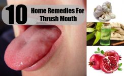 Home-Remedies-For-Thrush-Mouth.jpg